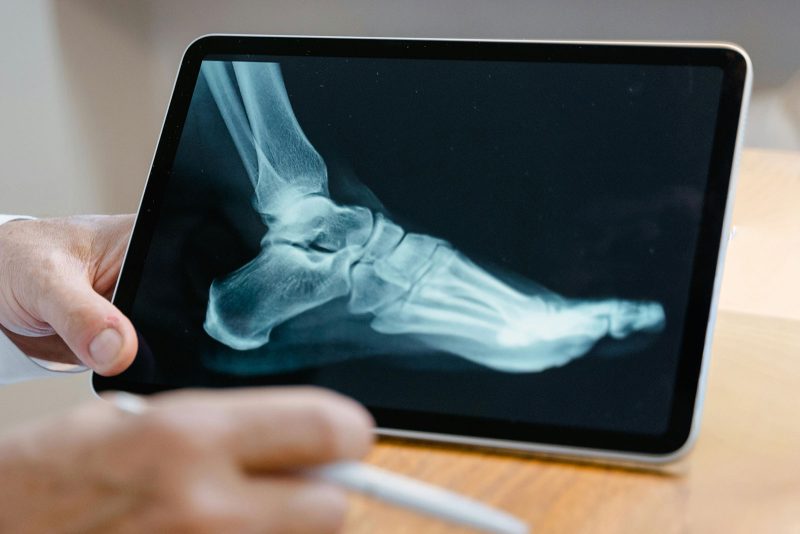 Port-Macquarie-podiatry